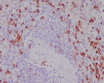 CD11b Antibody / MAC-1