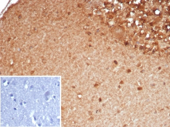IHC staining of FFPE human brain tissue with SLC18A2 antibody (clone SLC18A2/7983). Inset: PBS used 