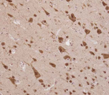 ELAVL2 Antibody / ELAV-like protein 2