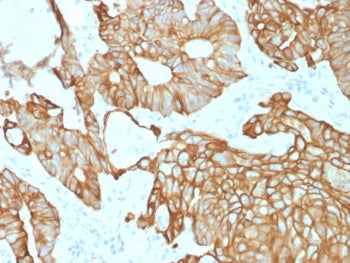 KRT19 Antibody / Cytokeratin 19