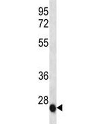 IL-6 Antibody, 0.4ml