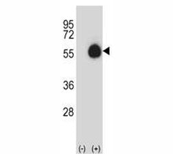 CD33 Antibody