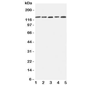 Western blot testing of Integrin alpha 7 antibody and Lane 1: 293T; 2: A431; 3: HeLa; 4: Jurkat; 5: 