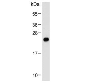 Neurogenin 3 Antibody / NGN3