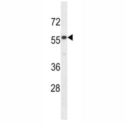 IL17RE Antibody