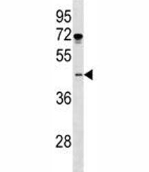 ISL1 Antibody