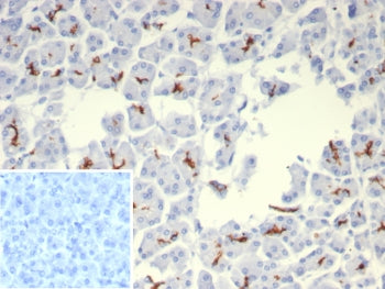 CFTR Antibody / Cystic Fibrosis Transmembrane Regulator