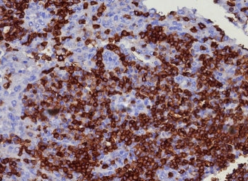 CD45RA Antibody (Leukocyte marker)