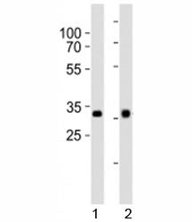 Western blot analysis of lysate from 1) HepG2 and 2) Y79 cell line using OTX2 antibody at 1:1000.