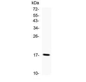 TNF alpha Antibody