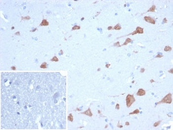 IHC staining of FFPE human brain tissue with RBFOX3 antibody (clone NEUN/7168). Inset: PBS used in p