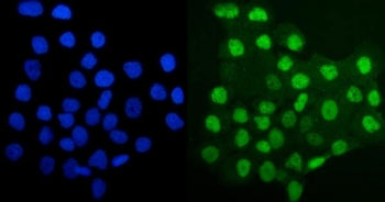 MCM4 Antibody
