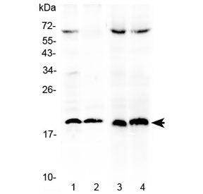TRAIL Antibody
