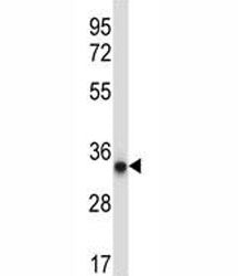 AMPK beta 2 Antibody (PRKAB2)