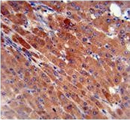 CES2 Antibody / Carboxylesterase 2