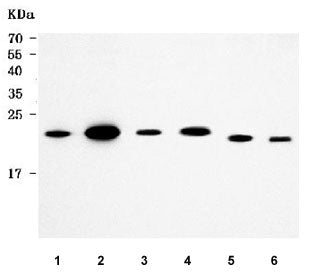 Western blot testing of 1) human Jurkat, 2) human 293T, 3) rat small intestine, 4) rat lung, 5) mous