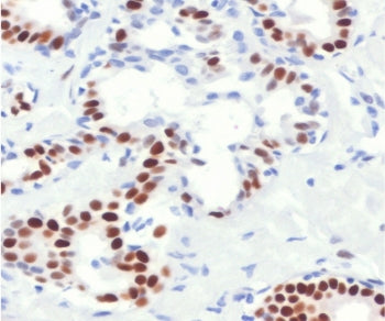 Estrogen Receptor alpha Antibody