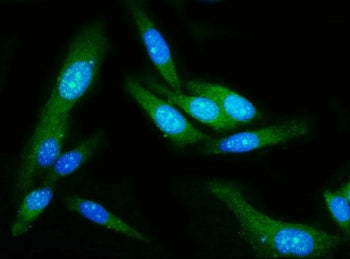 Immunofluorescent staining of FFPE human PC-3 cells with GSDMD antibody (green) and DAPI nuclear sta