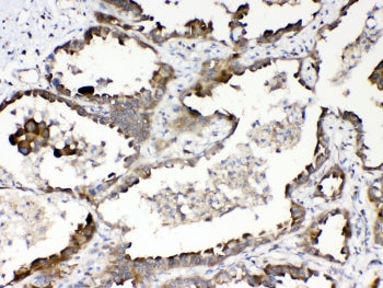 RanBP1 Antibody