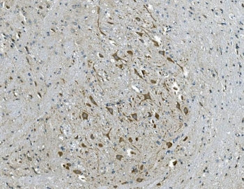 GABA A Receptor gamma 2 Antibody / GABRG2