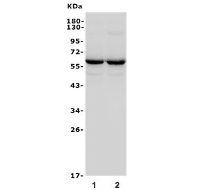GAD65 Antibody / GAD2