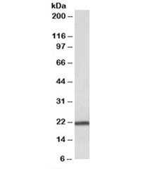 Western blot testing of human pancreas lysate with TMEM205 antibody at 0.03ug/ml. Predicted molecula