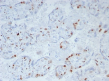 p57 Antibody / p57Kip2