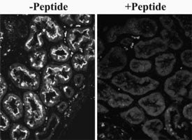 SLC26A6 Antibody