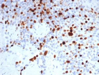 Topoisomerase II alpha Antibody / TOP2A