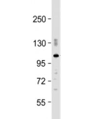 Western blot testing of mouse brain lysate with PDE2A antibody at 1:2000. Predicted molecular weight