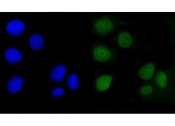 Immunofluorescent staining of FFPE human Caco-2 cells with Angiomotin antibody (green) and DAPI nucl
