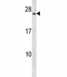 CD79a antibody western blot analysis in CEM lysate. Predicted/Observed molecular weight: 25~47 kDa d