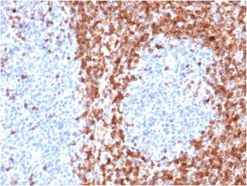 IHC staining of FFPE human tonsil tissue with recombinant Bcl-2 antibody (clone BCL2/6426R). HIER: b