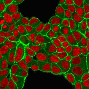 Immunofluorescent staining of PFA-fixed human MCF-7 cells with HER2 antibody (green) and Reddot nucl