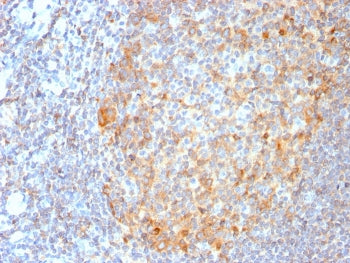 MALT1 Antibody