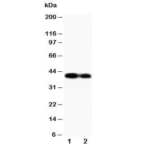 Western blot testing of Connexin 40 antibody different lots of mouse heart tissue lysate. Predicted 