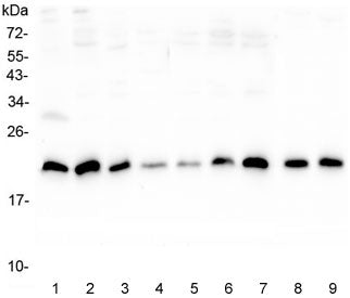 Western blot testing of human 1) placenta, 2) U-2 OS, 3) A431, 4) PC-3, 5) HL-60, 6) K562, 7) Caco-2