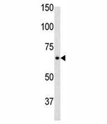 Glial fibrillary acidic protein Antibody