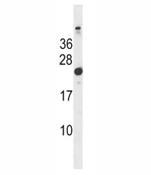 Hras Antibody