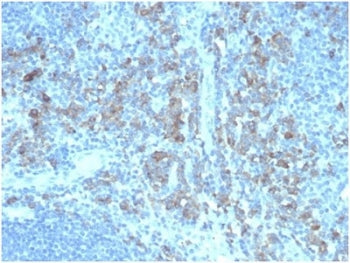 CD5L Antibody / CD5 Ligand