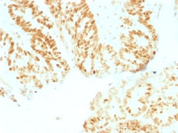 IHC testing of human colon with Rb antibody (clone RB1/1754). Required HIER: boil tissue sections in