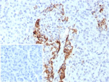 Insulin Antibody