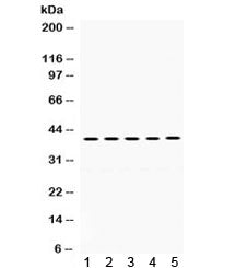 Oncostatin M Antibody / OSM