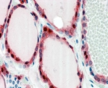 Frizzled 2 Antibody
