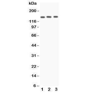 Angiotensin Converting Enzyme Antibody (ACE)