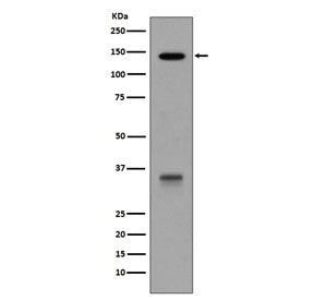 LDLR Antibody / LDL Receptor
