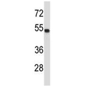 TUBA4A Antibody (Tubulin alpha 4A)