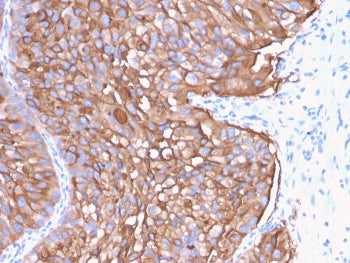 Uroplakin 1A Antibody / UPK1A