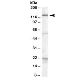 Western blot testing of human liver lysate with DAGLA antibody at 0.3ug/ml. Predicted molecular weig