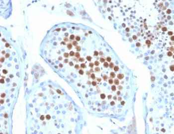 IHC staining of FFPE human testis tissue with MCAK antibody (clone KIF2C/6522) at 2ug/ml. HIER: boil